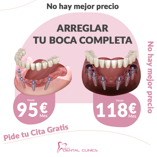 Grupo Dental Clinics Facebook ad