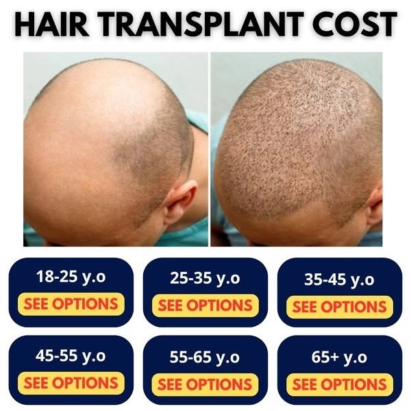 HairGet by Dr Kazi Facebook ad: FREE consultation