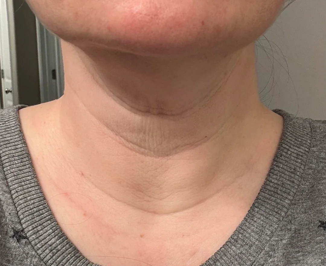 Michelle J Wellness Path Facebook ad: Read this if nothing has worked for your crepey skin