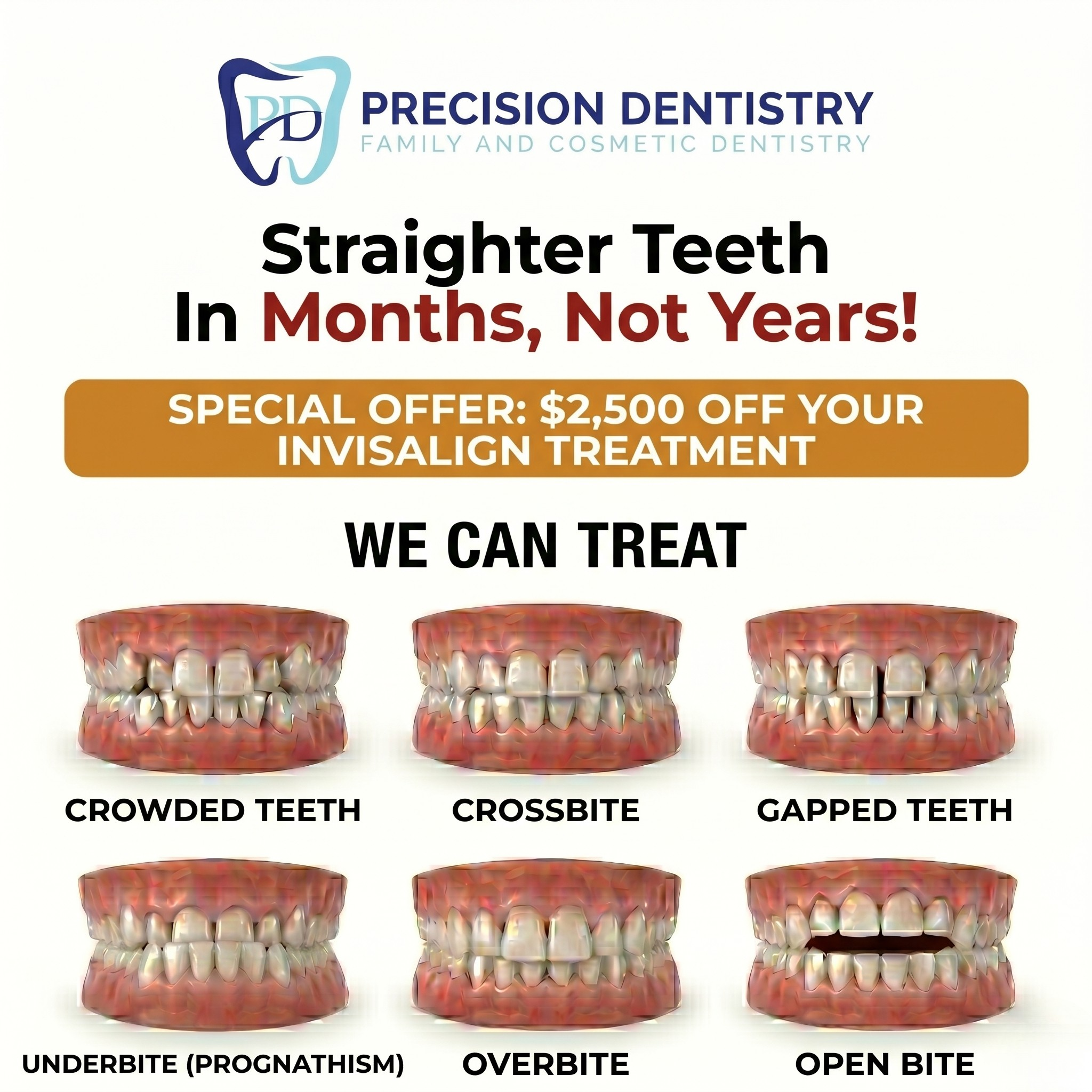 Precision Dentistry in Columbia, MD Facebook ad: $𝟐,𝟓𝟎𝟎 𝐎𝐅𝐅 𝐈𝐧𝐯𝐢𝐬𝐚𝐥𝐢𝐠𝐧! 𝐏𝐥𝐚𝐧𝐬…