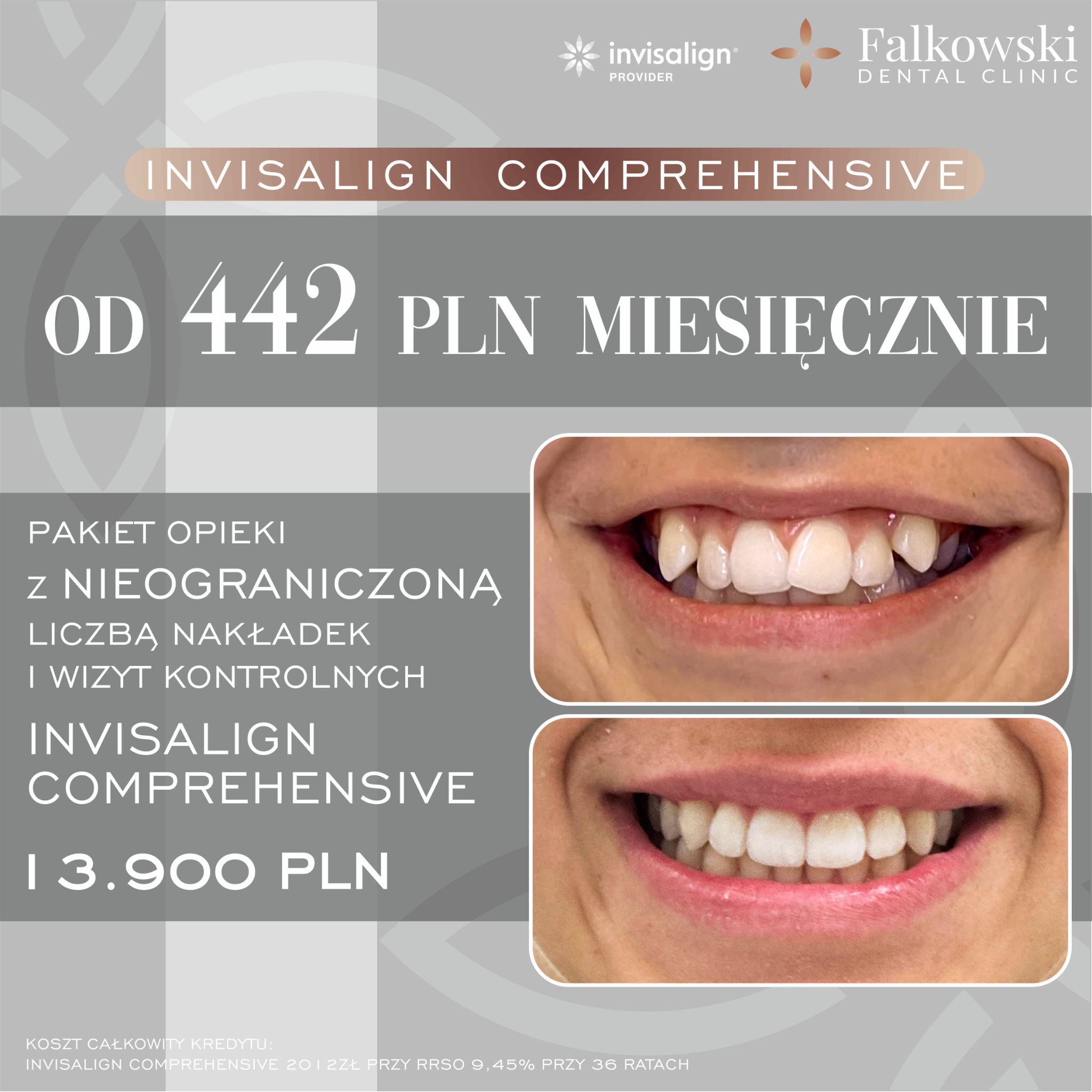 Falkowski Dental Clinic Facebook ad