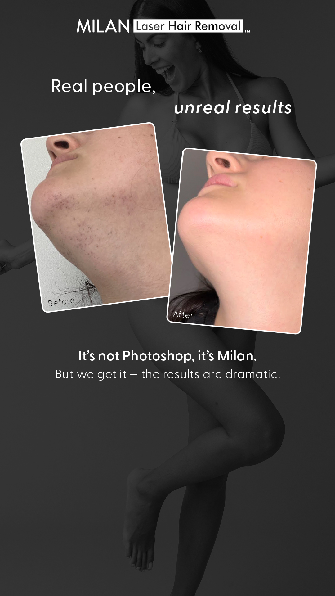 Milan Laser Hair Removal Facebook ad