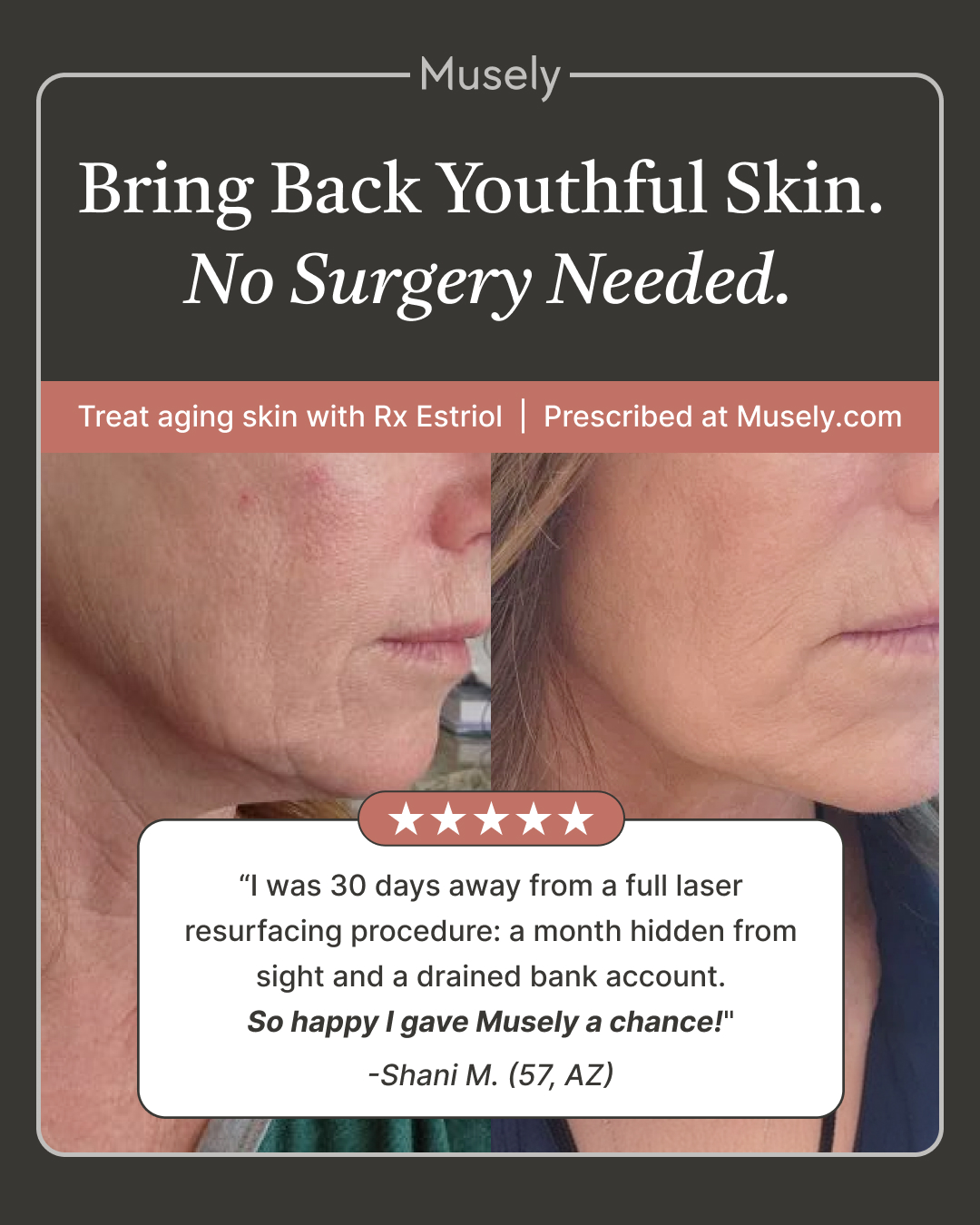 Musely Facebook ad