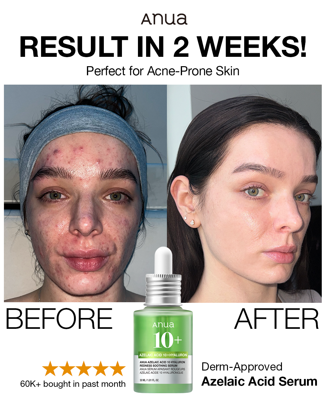 ANUA_Global Facebook ad
