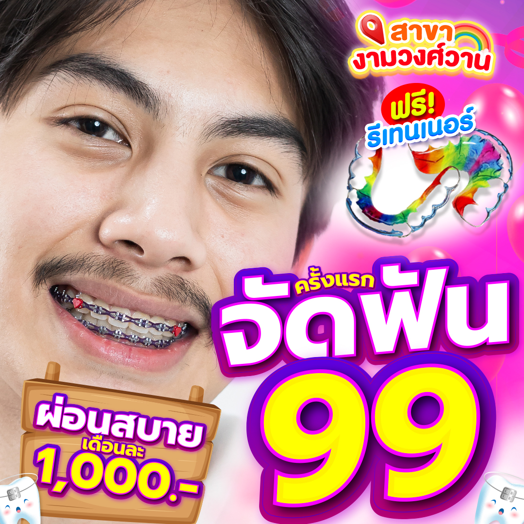 แหล่งรวมโปรโมชั่นจัดฟันดีสุด Facebook ad