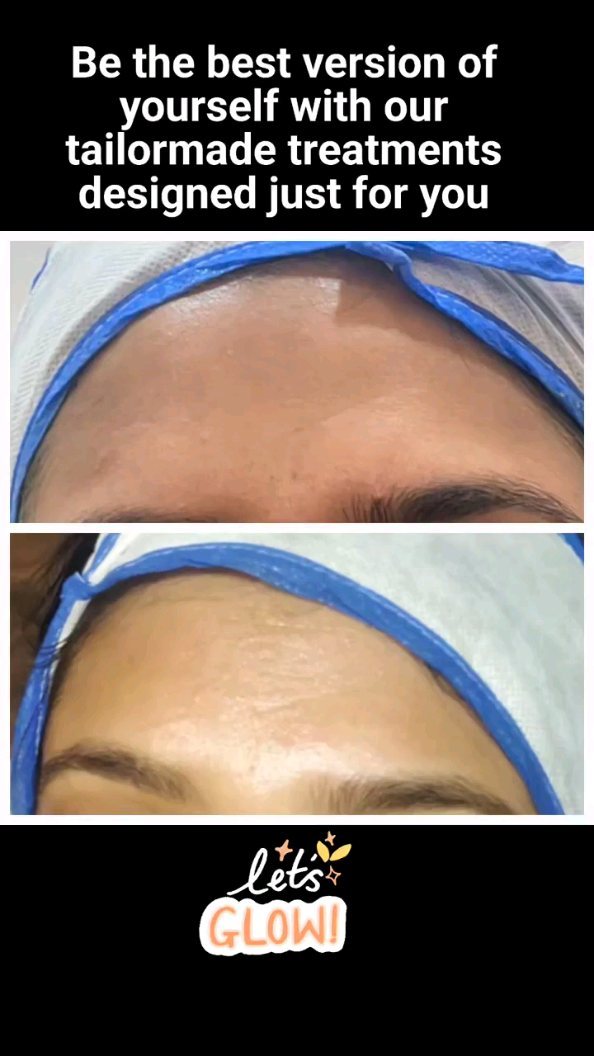 Maya Aesthetic Clinic Facebook ad: Get your hidden glow with our tailormade customized…