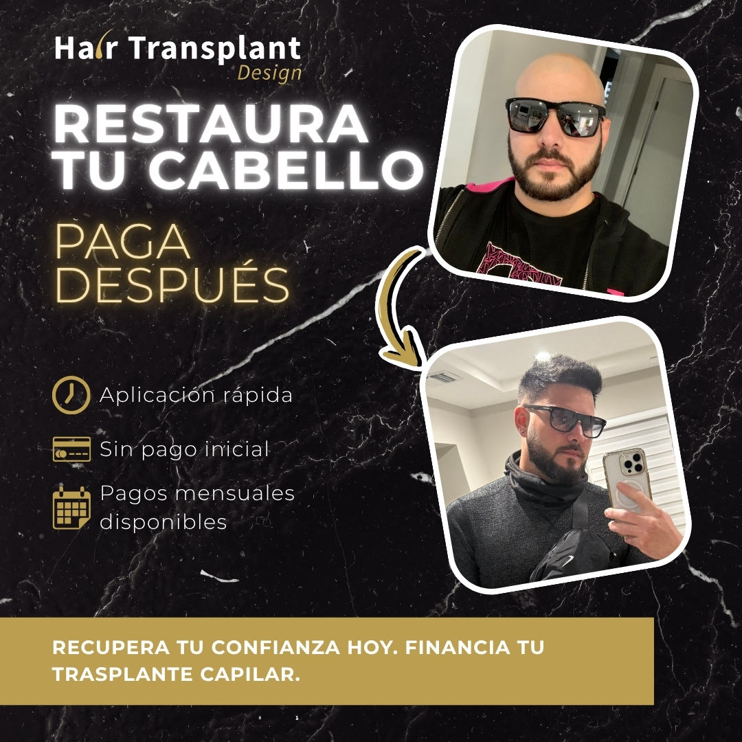 Hair Transplant Design Facebook ad
