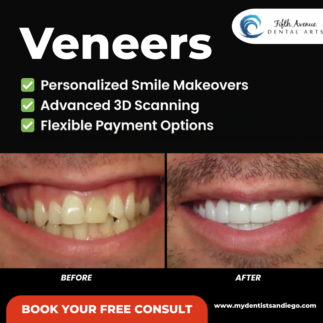 Fifth Avenue Dental Arts Facebook ad: Schedule Your Free Consult
