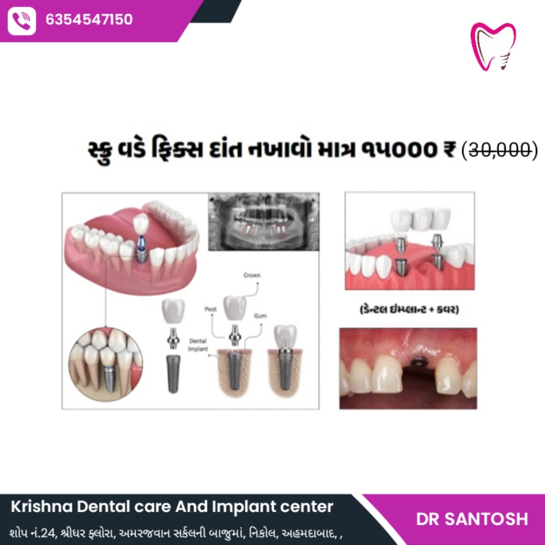 Krishna Dental care and implant center Facebook ad: Chat with us