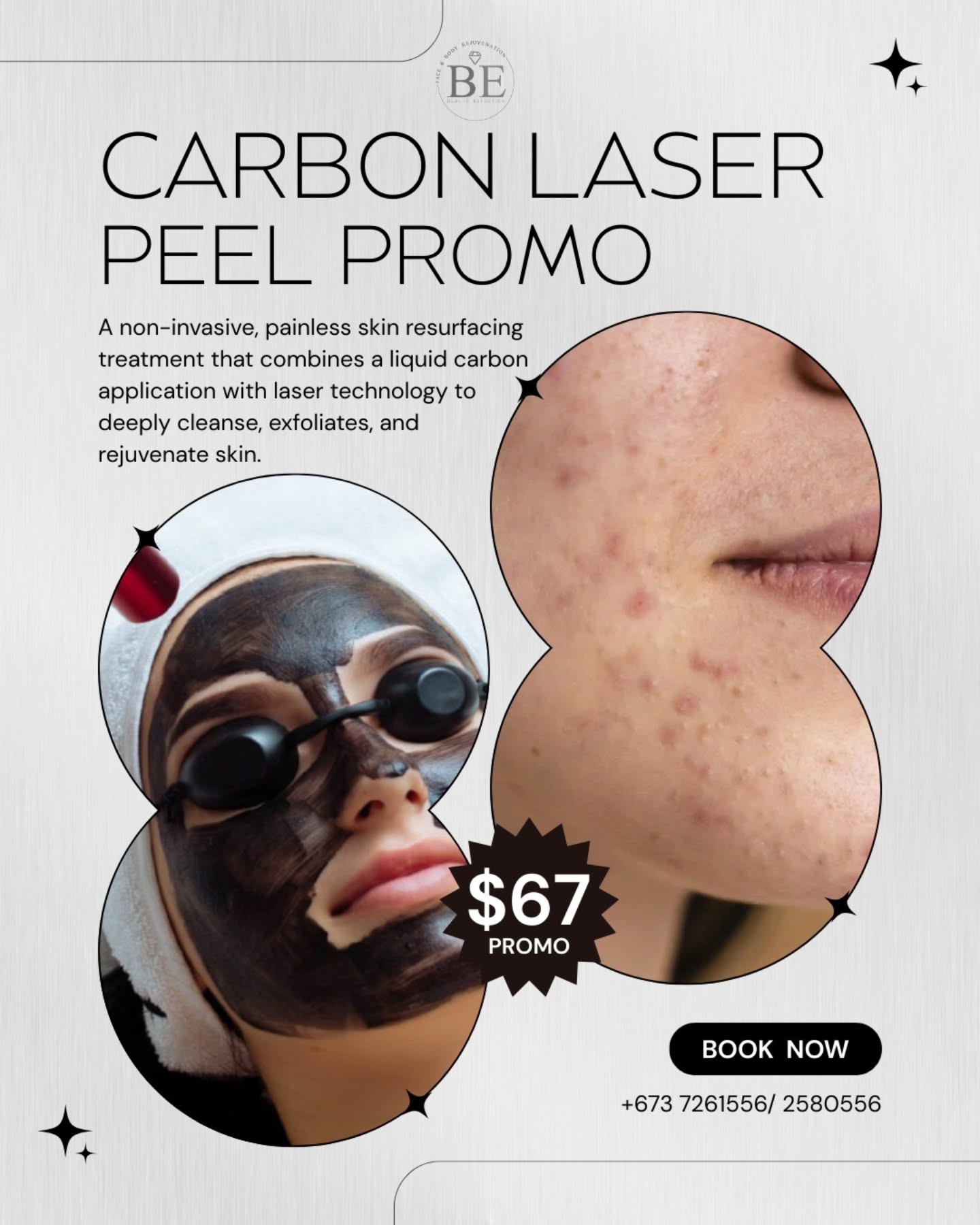 Beaute Esthetics Brunei Facebook ad: IT'S SIX-SEVENNNN ONLY!