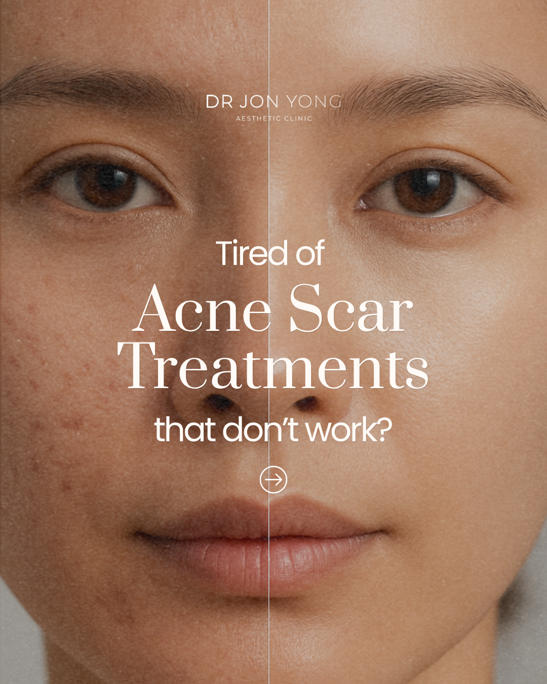Dr Jon Yong Aesthetic Clinic Facebook ad