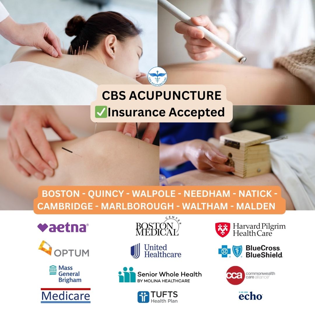 CBS Acupuncture Facebook ad: Acupuncture That Works.