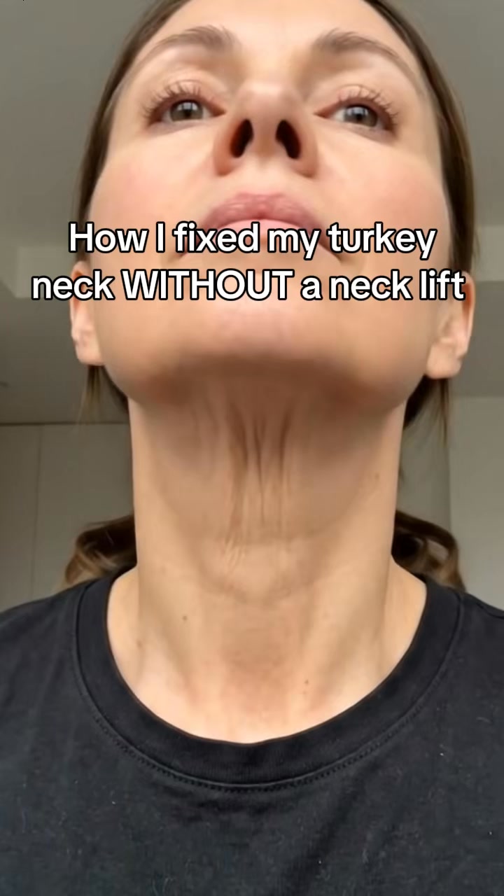 Hey Bud Skincare Facebook ad: The $40 serum women are trying before a $10,000 neck lift