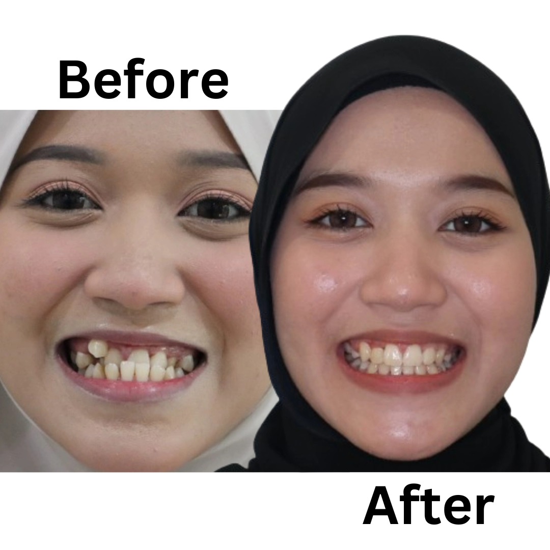 Klinik Pergigian Dr Smile Taman Equine Facebook ad