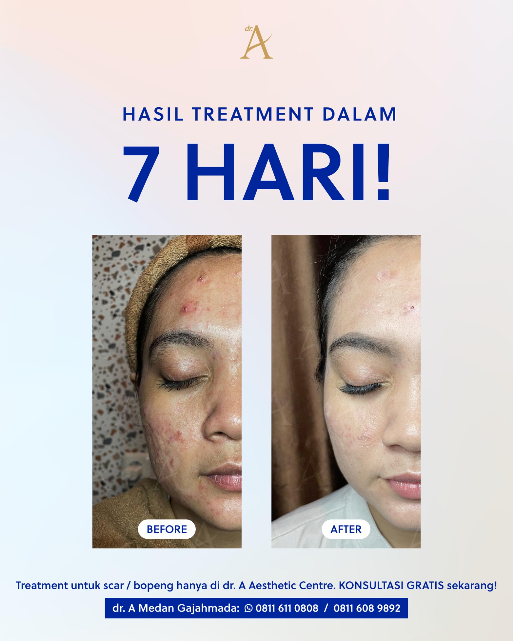 Dr. A Aesthetic Centre Facebook ad