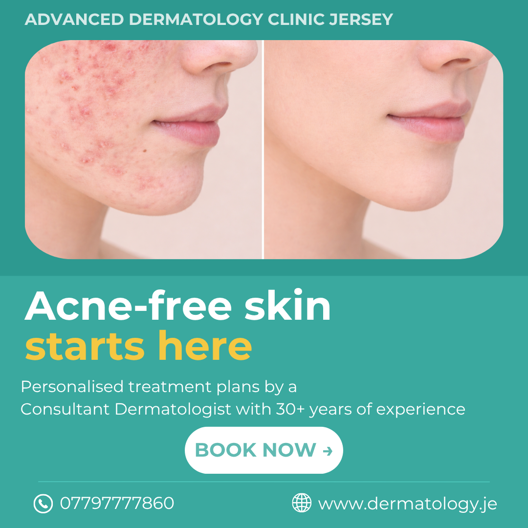 Advanced Dermatology Clinic Jersey Facebook ad
