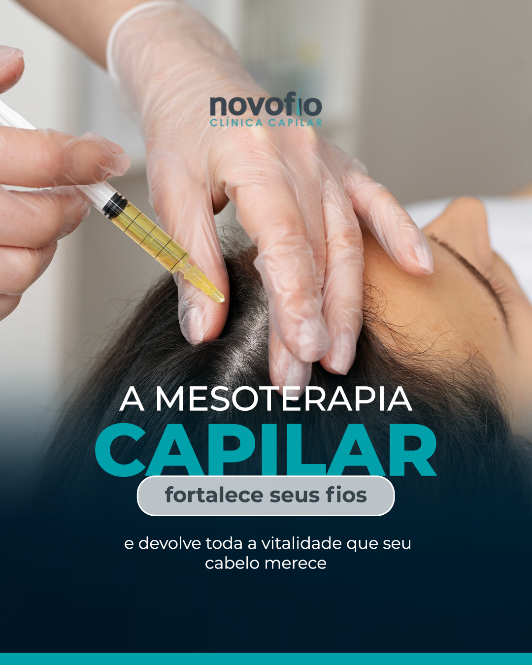 Novofio Natal Clínica Capilar Facebook ad
