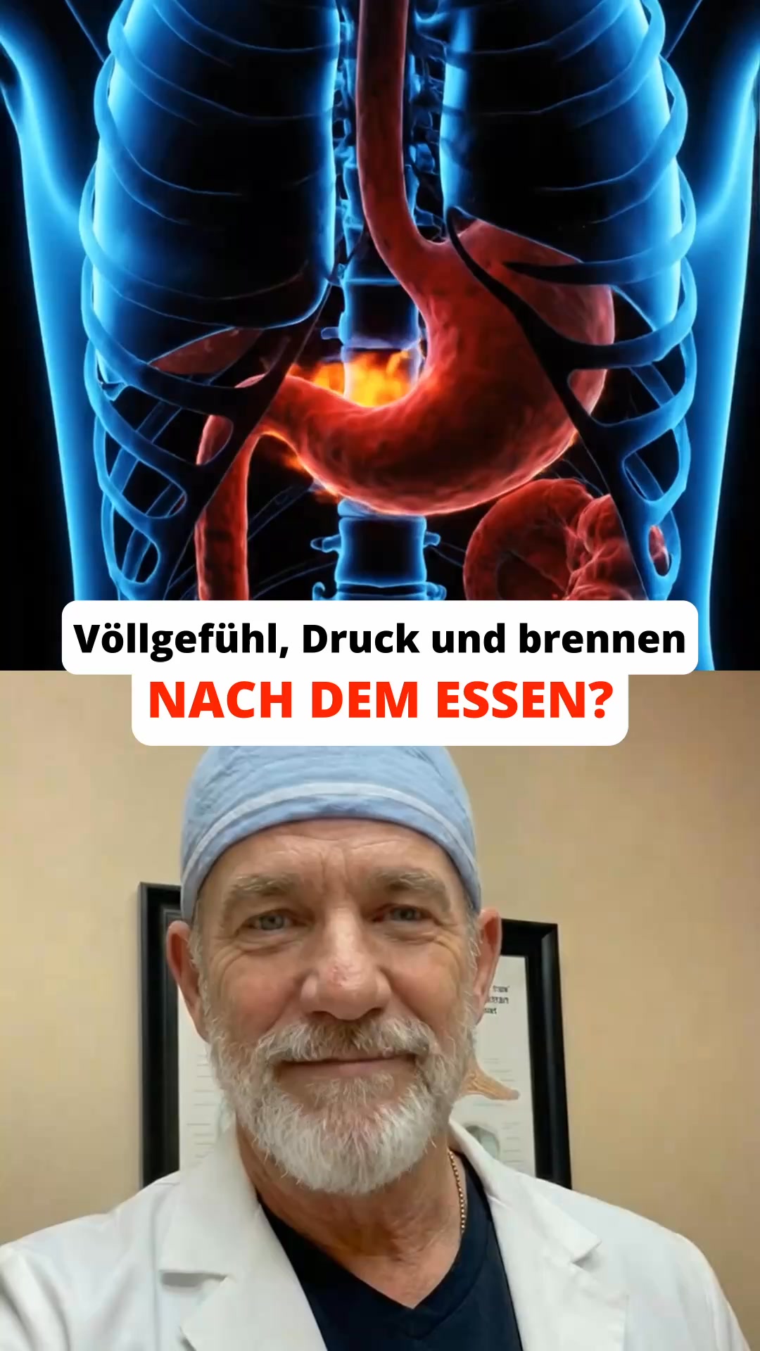 Magengesund Facebook ad: Sodbrennen? Erfahre, was wirklich