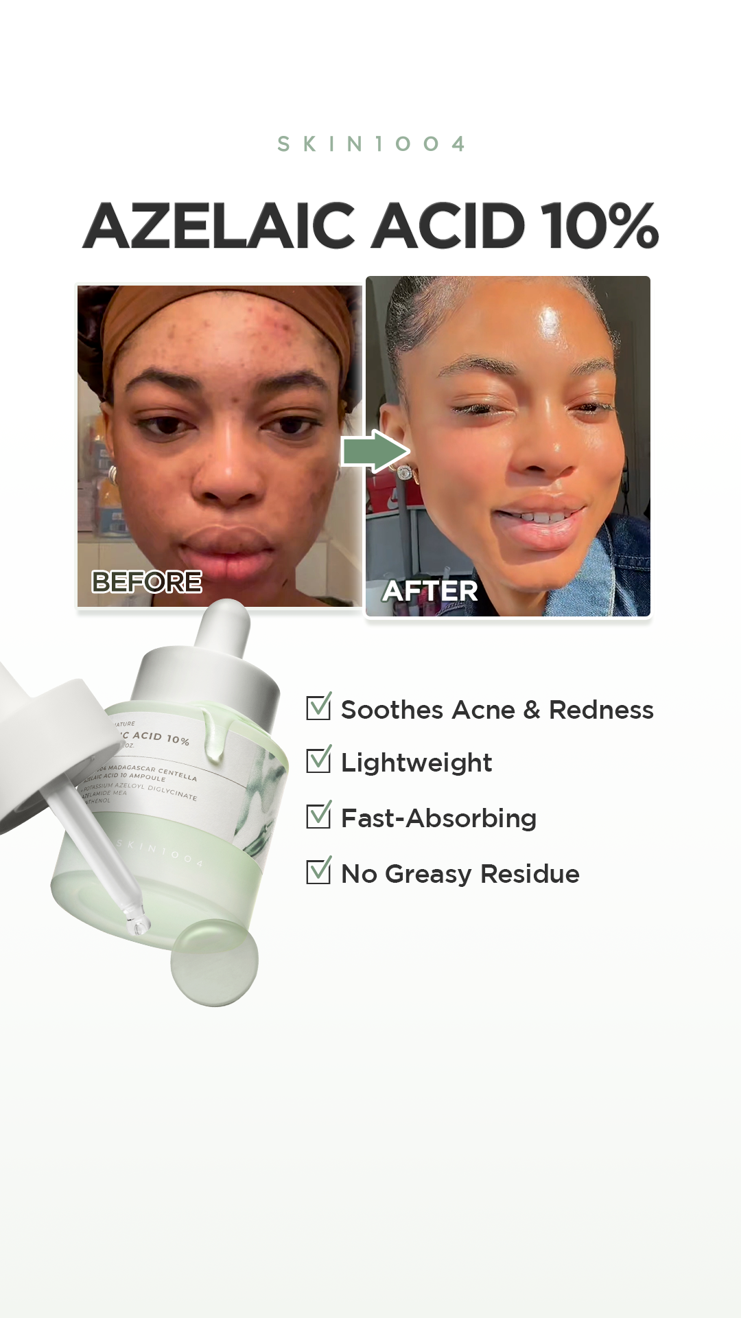 SKIN1004 Facebook ad