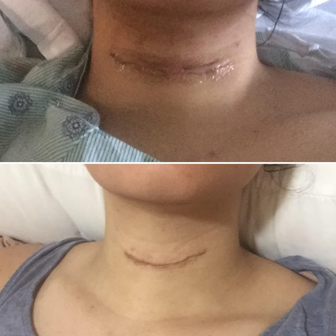 Thyroid Health Daily Facebook ad: Read this if you refused to take GLP-1