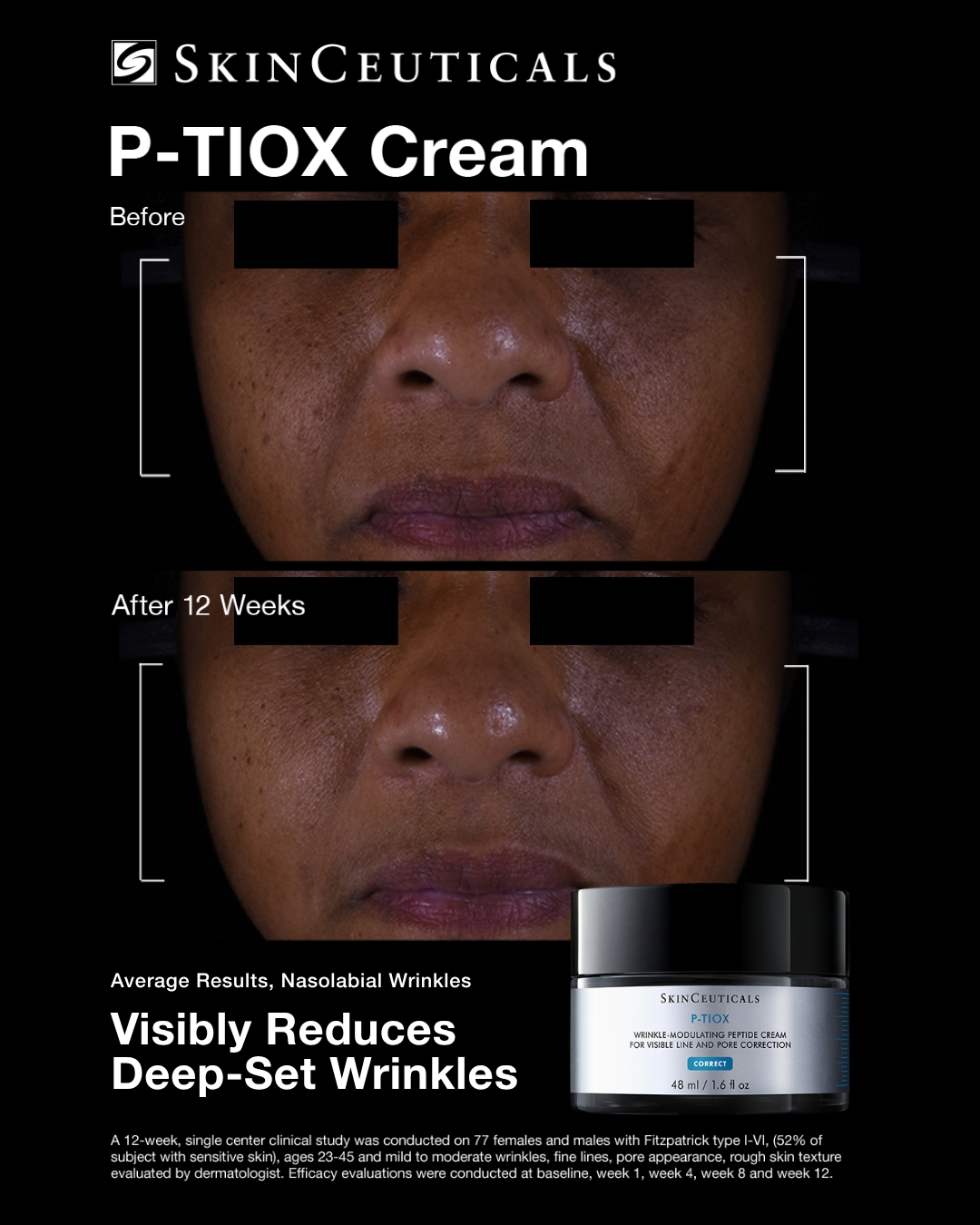 SkinCeuticals Facebook ad