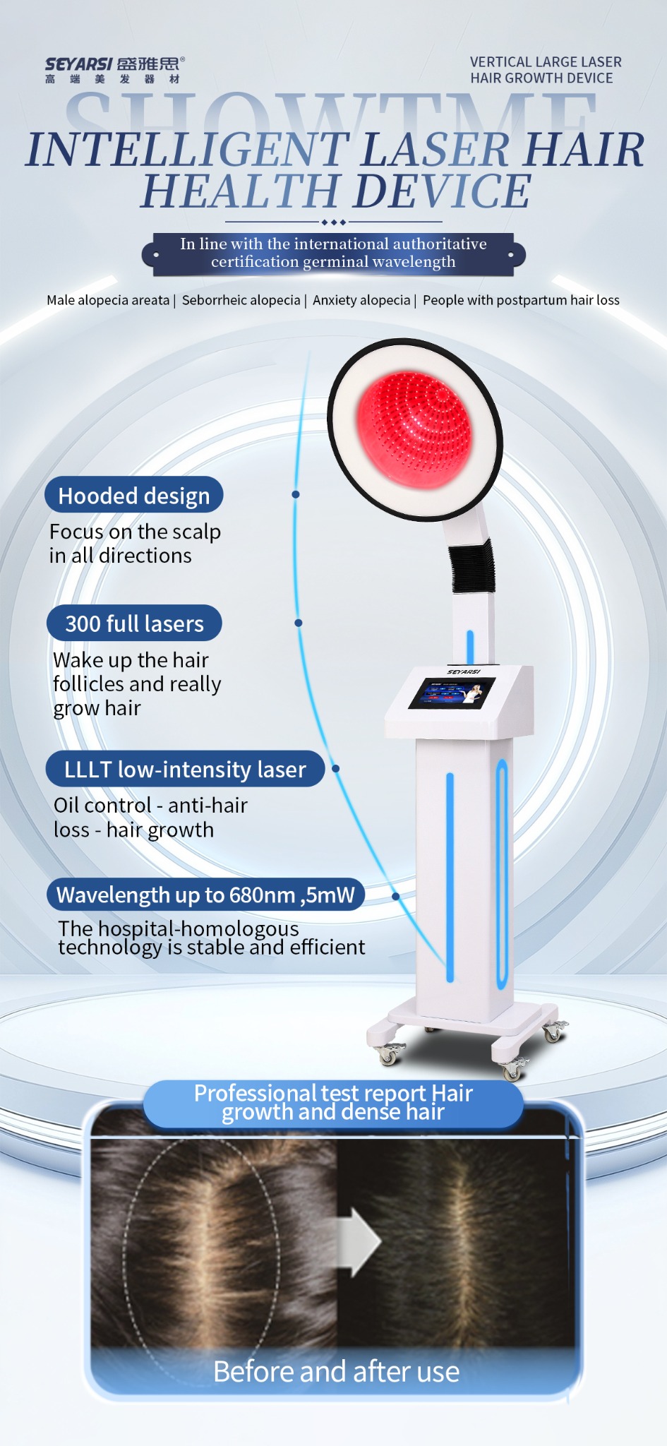 SEYARSI-HairEquipment Facebook ad: Professional Hair Follicle Care Device for Salons