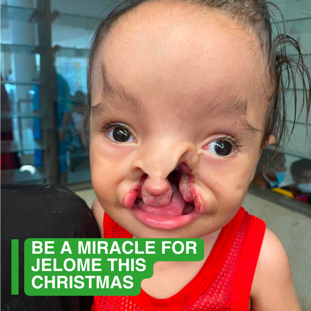 Children First Foundation Facebook ad: Help him now