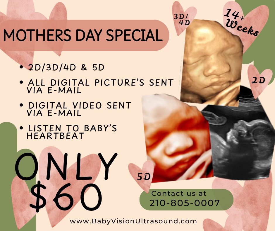 BabyVision Ultrasound Facebook ad: Mother’s Day Special