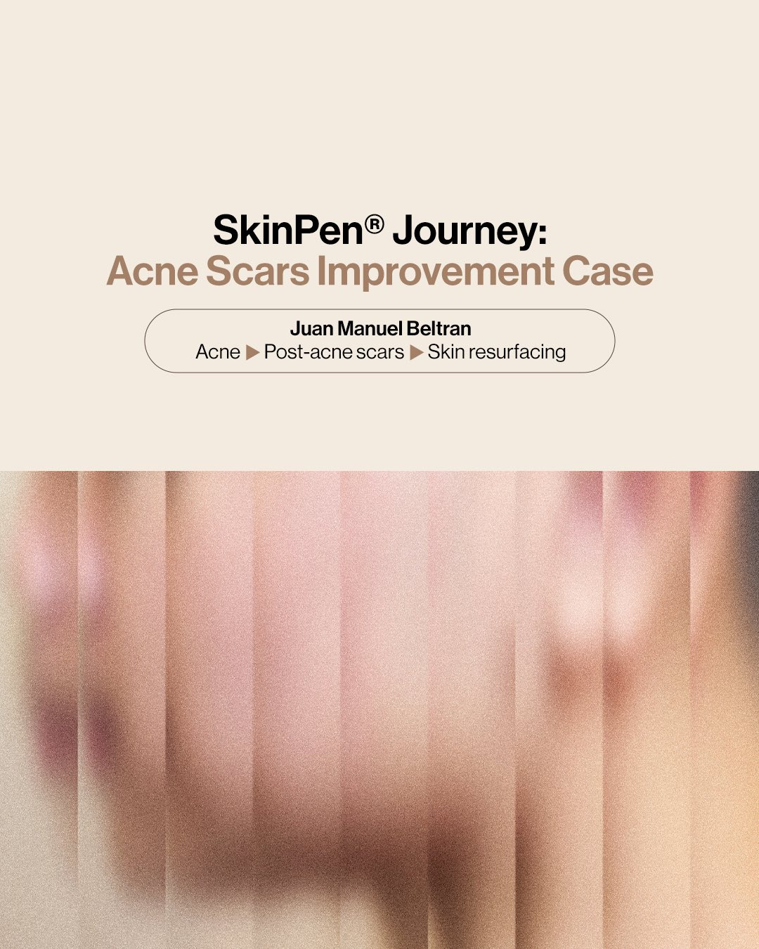 Skin Solutions Facebook ad