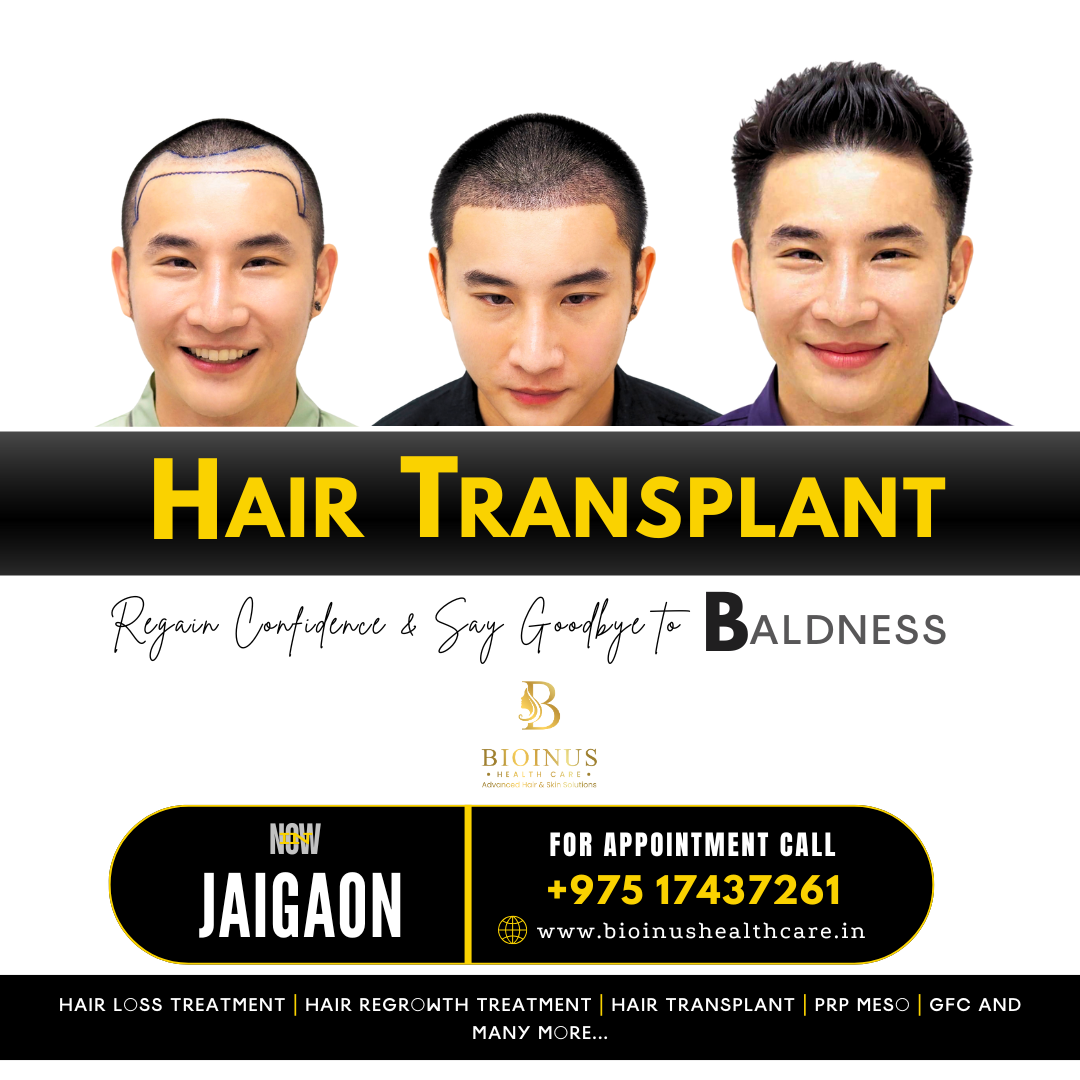 Bioinus Healthcare Advanced Hair & Skin Solutions, Jaigaon Facebook ad