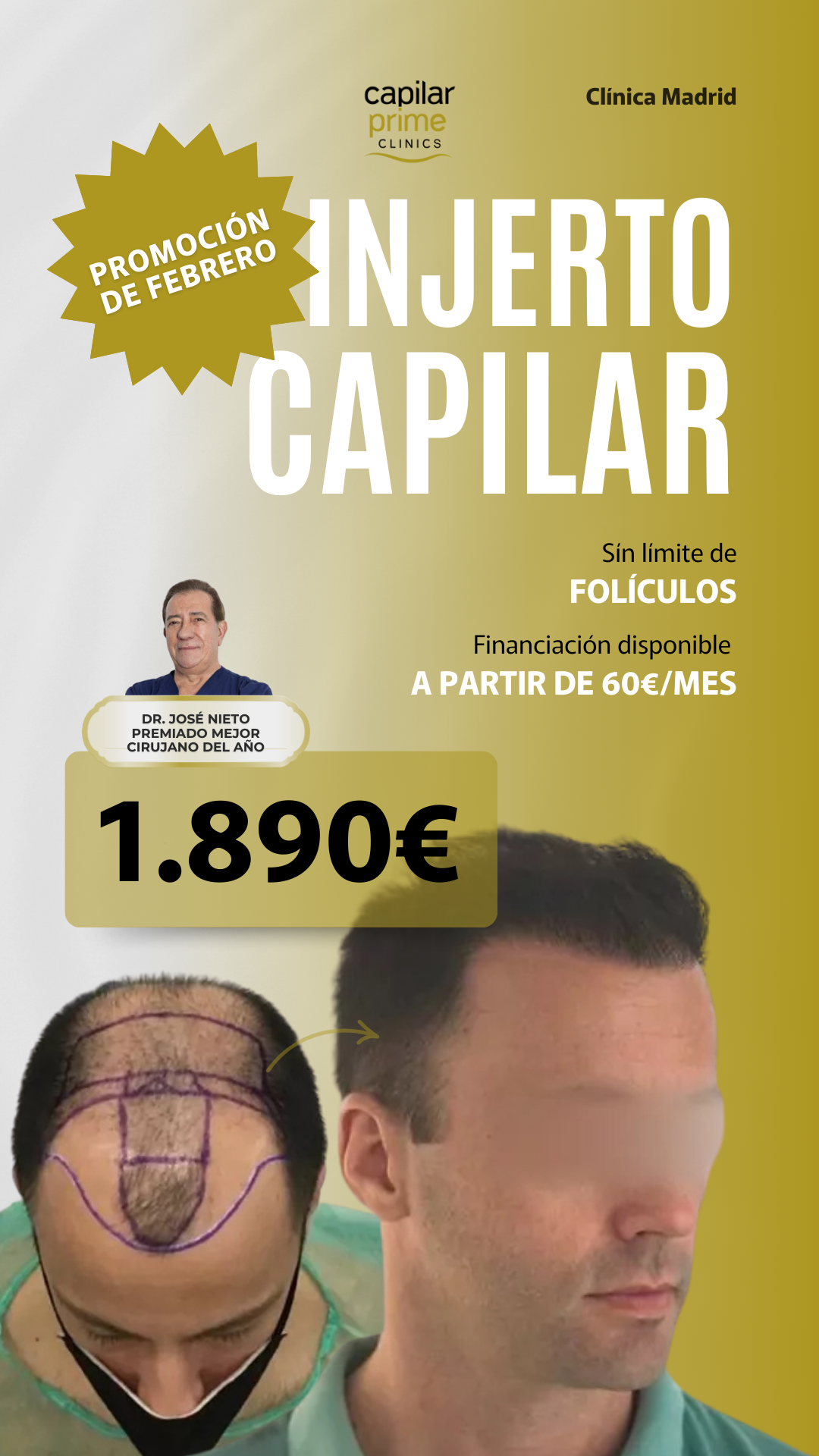 Capilar Prime Clinics Facebook ad from Feb 3, 2026