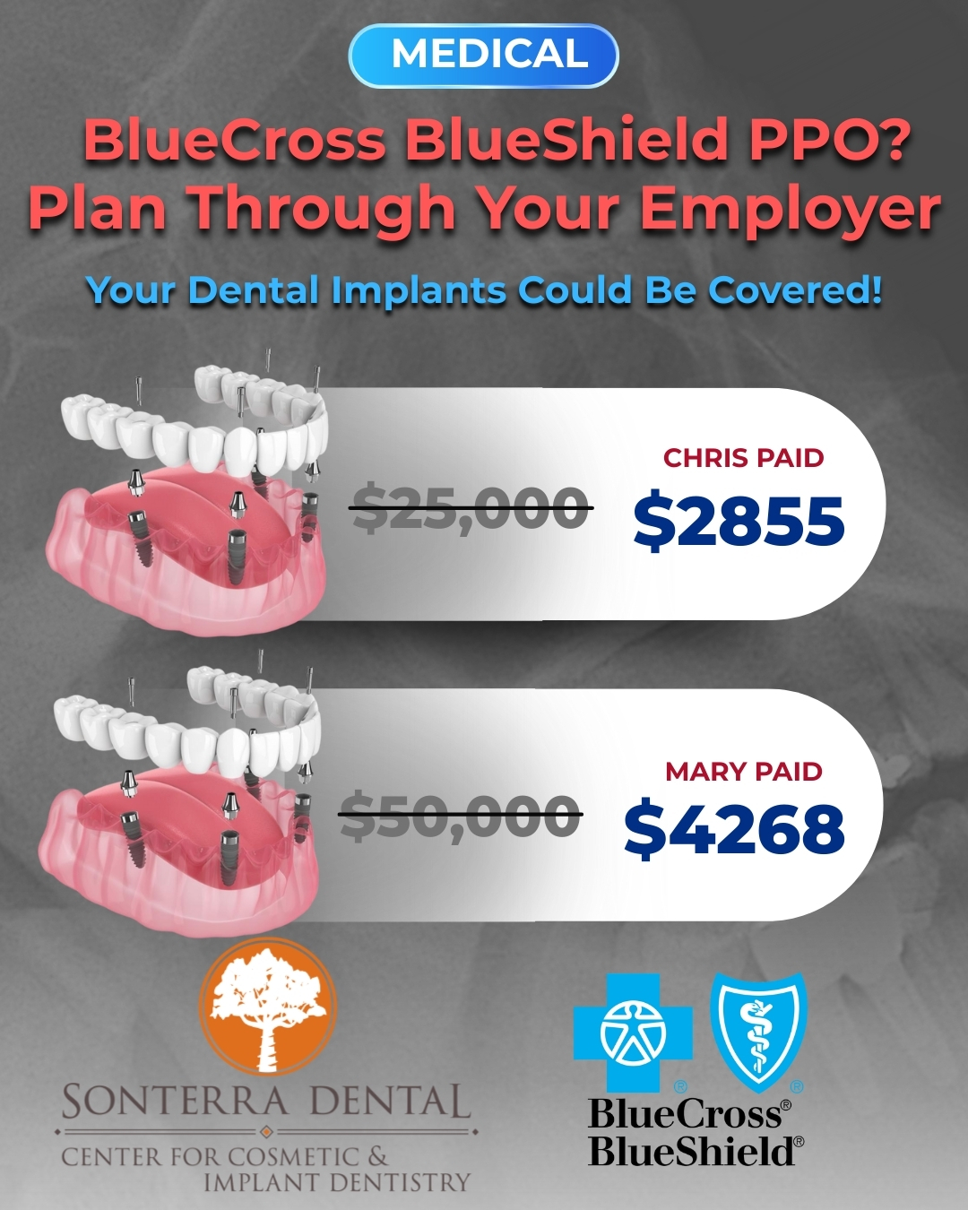 Sonterra Dental - Center for Cosmetic and Comprehensive Dentistry Facebook ad: See If Your Plan May Help Cover Implants