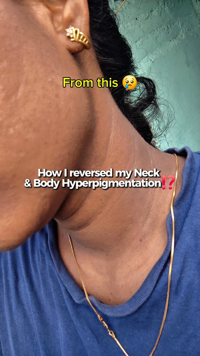 Ai doctor Sahab Facebook ad: My neck & body brightening skincare routine for…