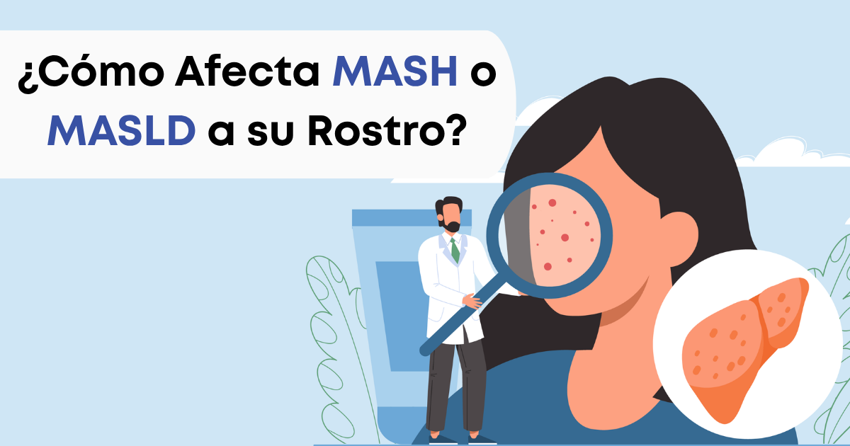 myMASHteam Facebook ad: Señales Faciales Comunes en MASH o MASLD