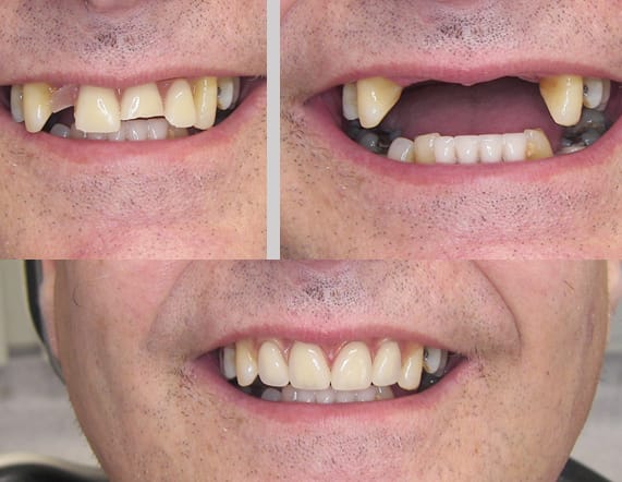 new smile Facebook ad: WhatsApp or phone