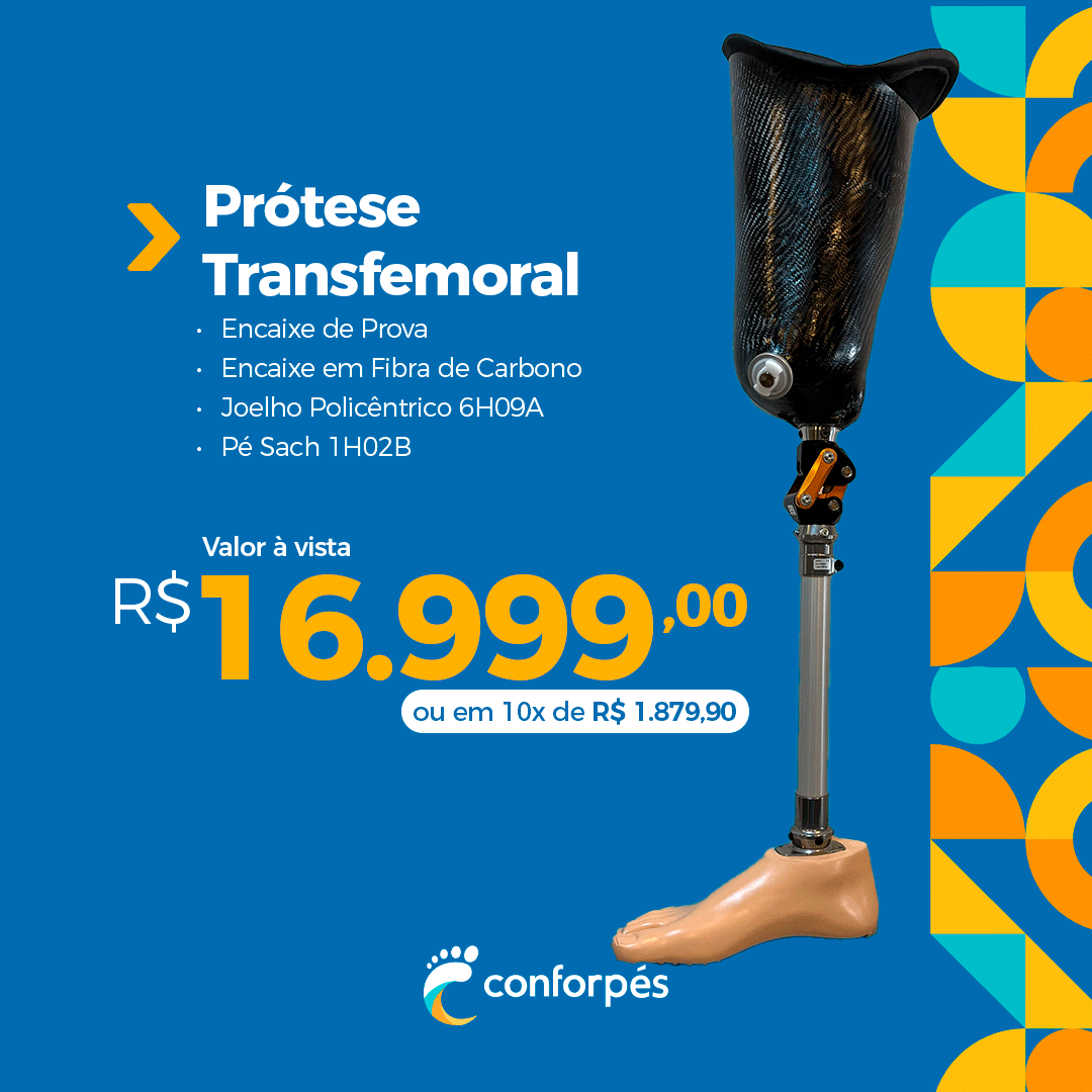 Ortopedia Conforpés Prótese Órtese Facebook ad: Agendar Avaliação Gratuita