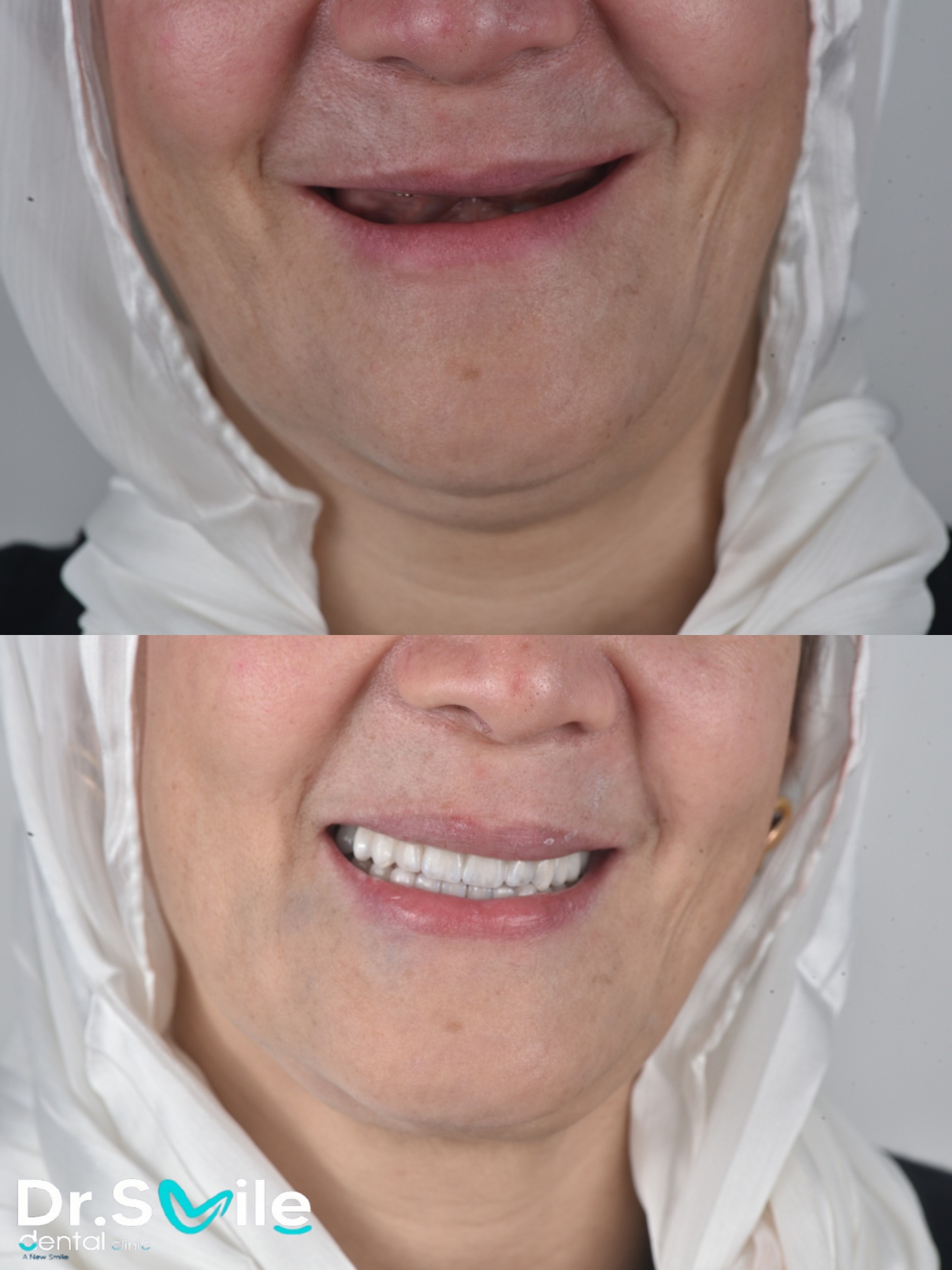 Dr.Smile Dental Clinic - لزراعة وتجميل الأسنان Facebook ad