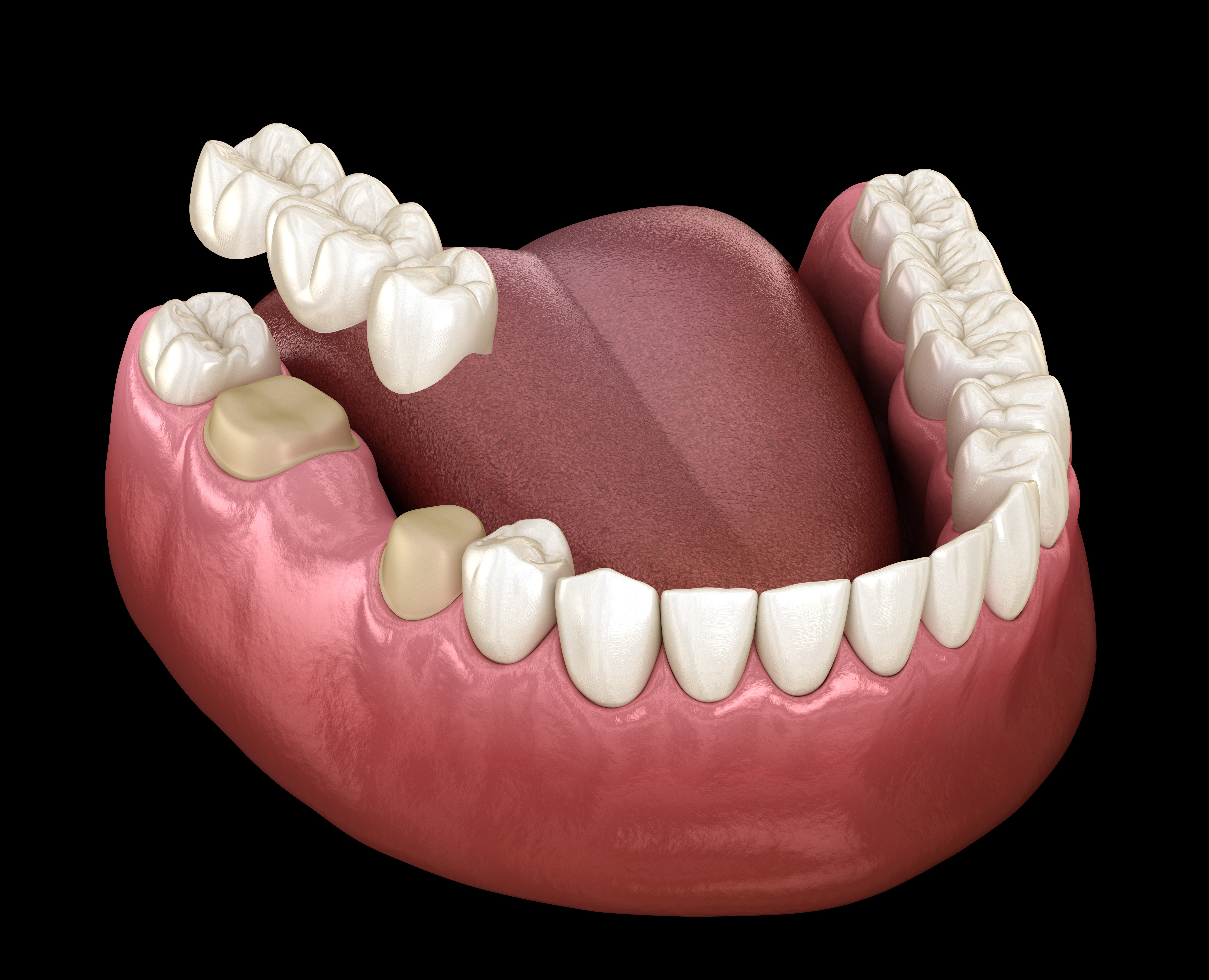 Dentist Near Me Riverside Facebook ad