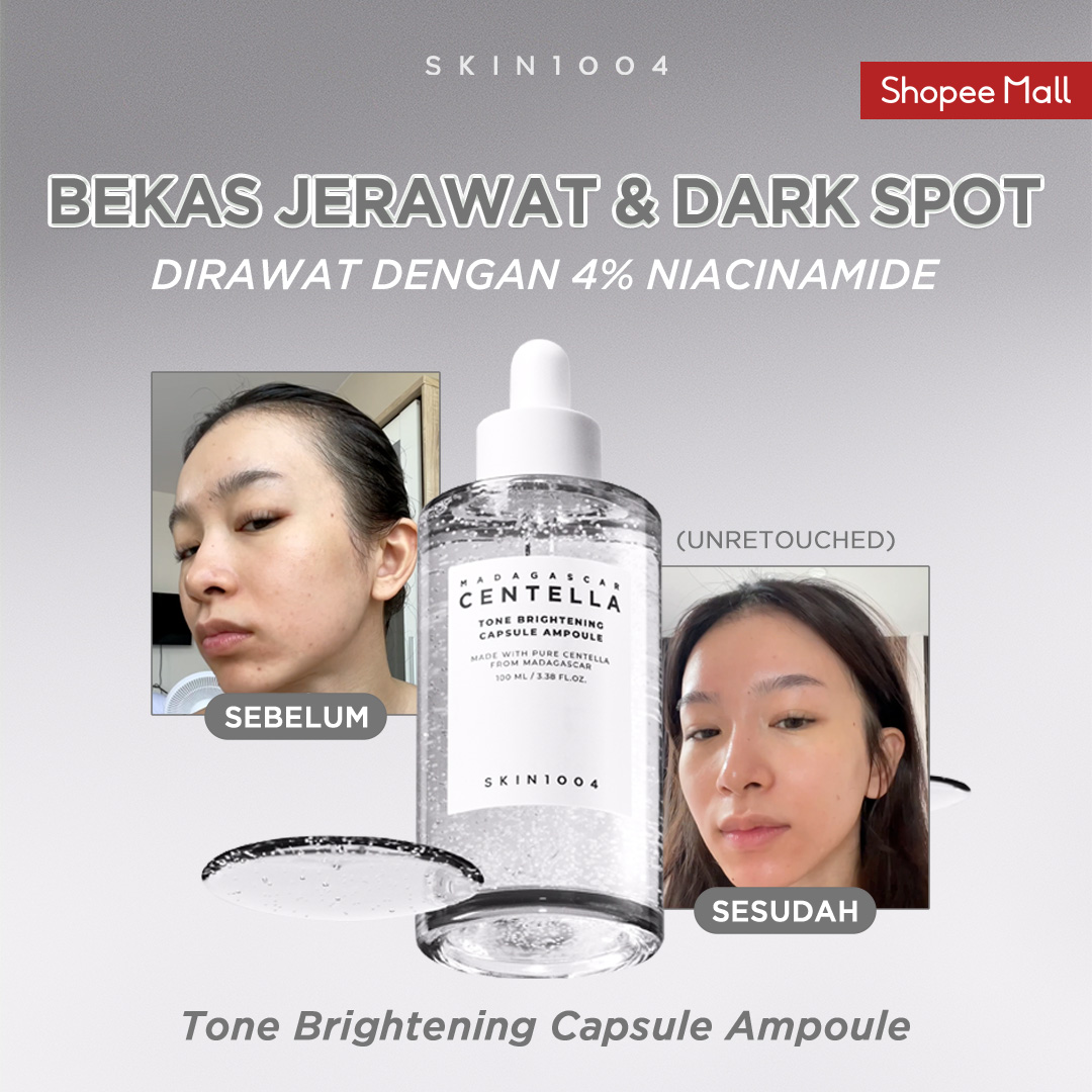 SKIN1004_Indonesia Facebook ad