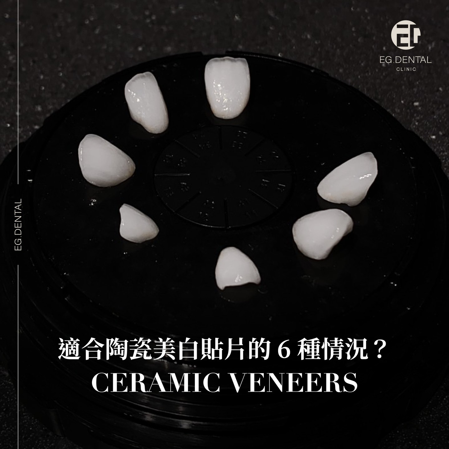 EG Dental 敦南 上境 Facebook ad: 一分鐘測驗!