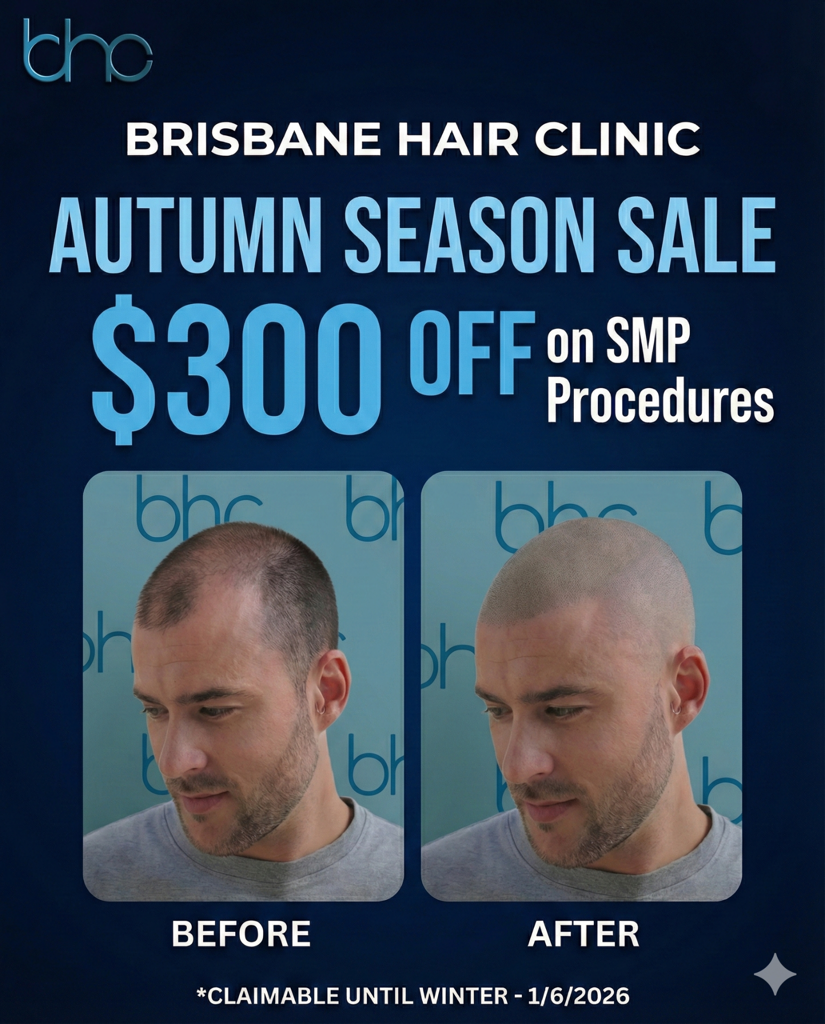 Brisbane Hair Clinic Facebook ad: Confidence Upgrade, Limited Offer
