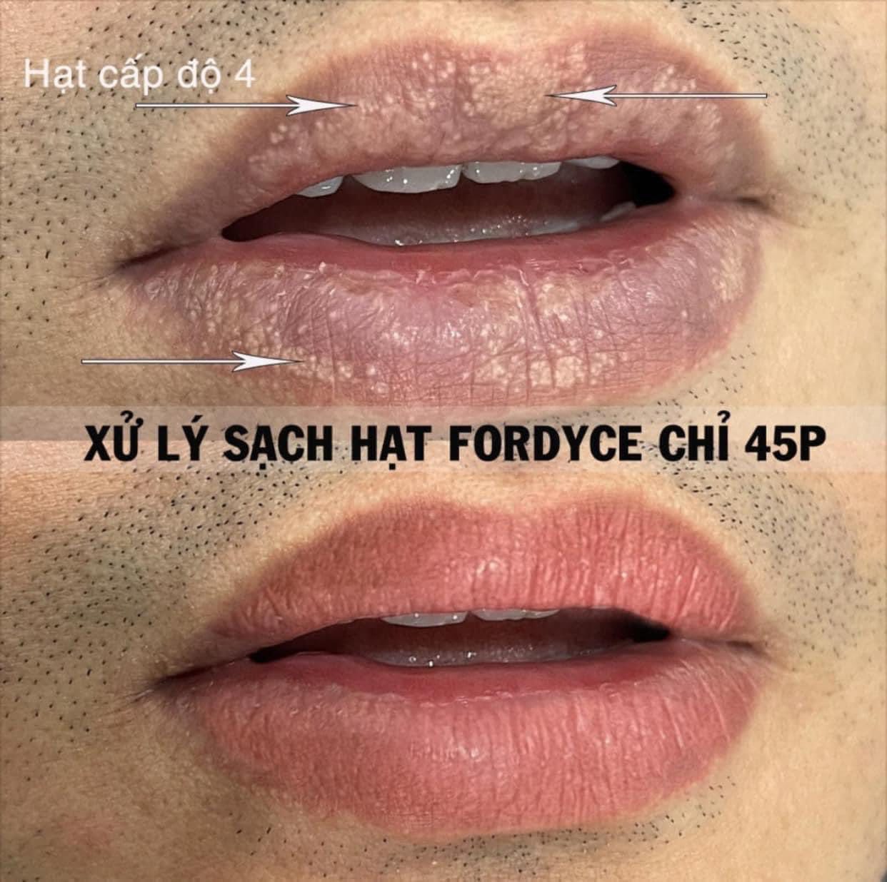 Thẩm Mỹ Quốc Tế Linh Anh - Thủ Dầu Một, Bình Dương Facebook ad: Ưu đãi GIẢM SÂU chỉ còn 1/3 giá gốc!