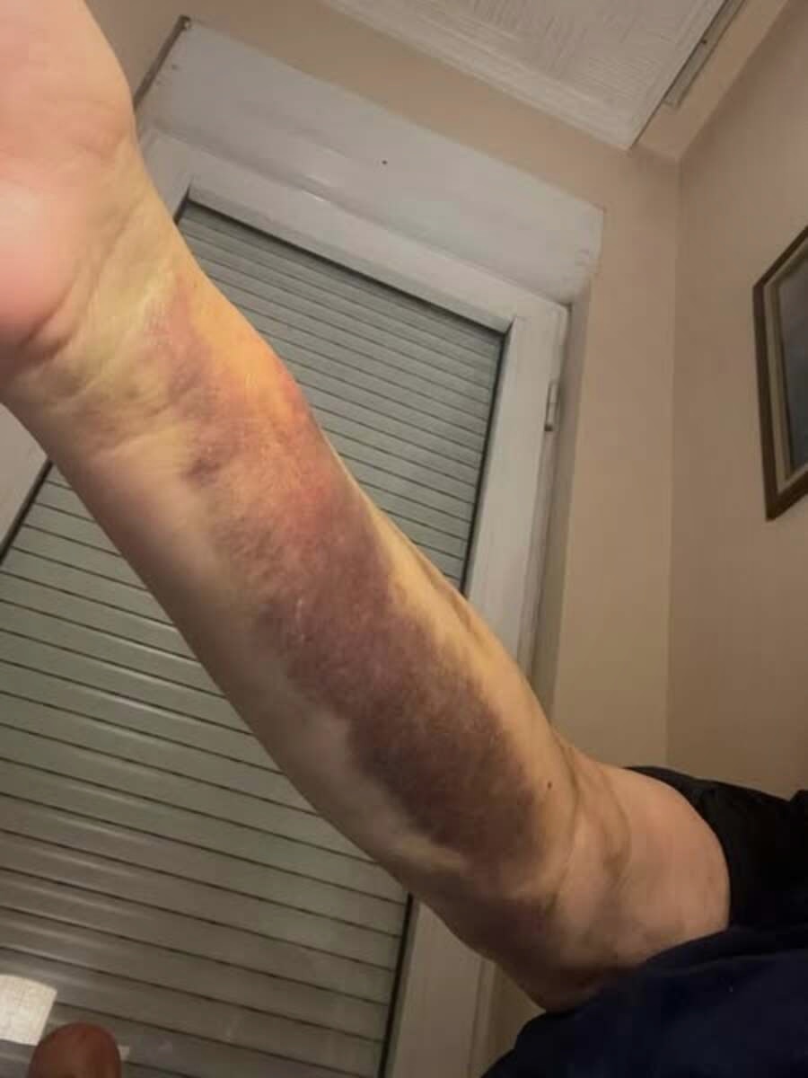 Barbara Turner Facebook ad: Type 2 Diabetics: This Itch Is A Warning.