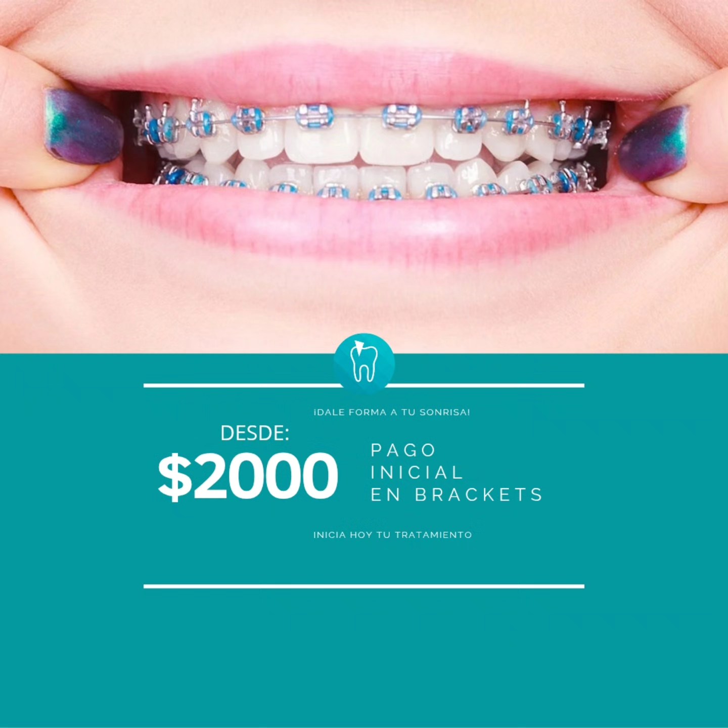 Cisgar Dental Facebook ad: ¡ATENCIÓN ZAMORA!