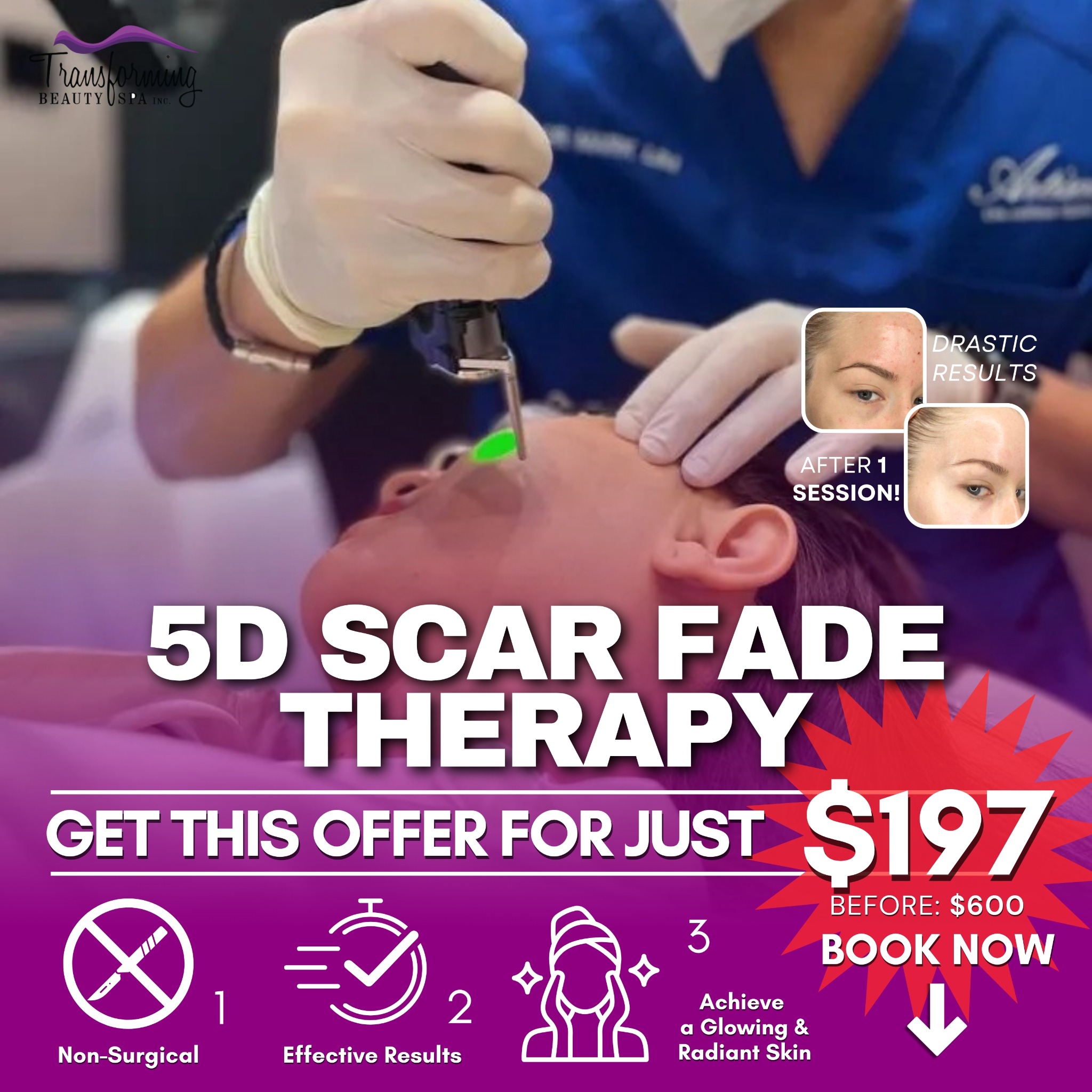 Transforming Beauty Facebook ad: 5D Scar Fade Therapy For $197 Only