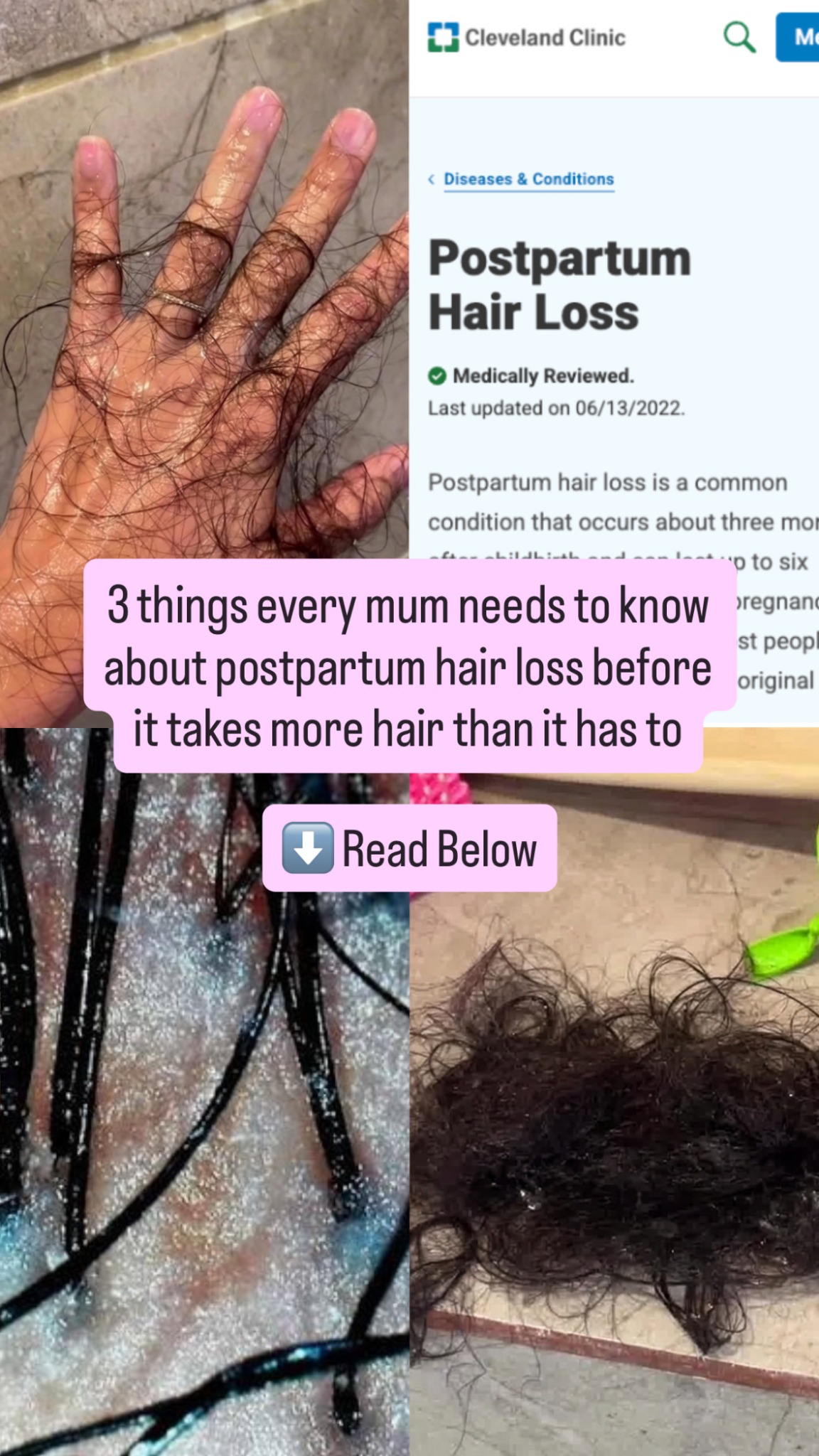 Bara'a Herbal Facebook ad: Your postpartum shedding isn't just hormones, read more here