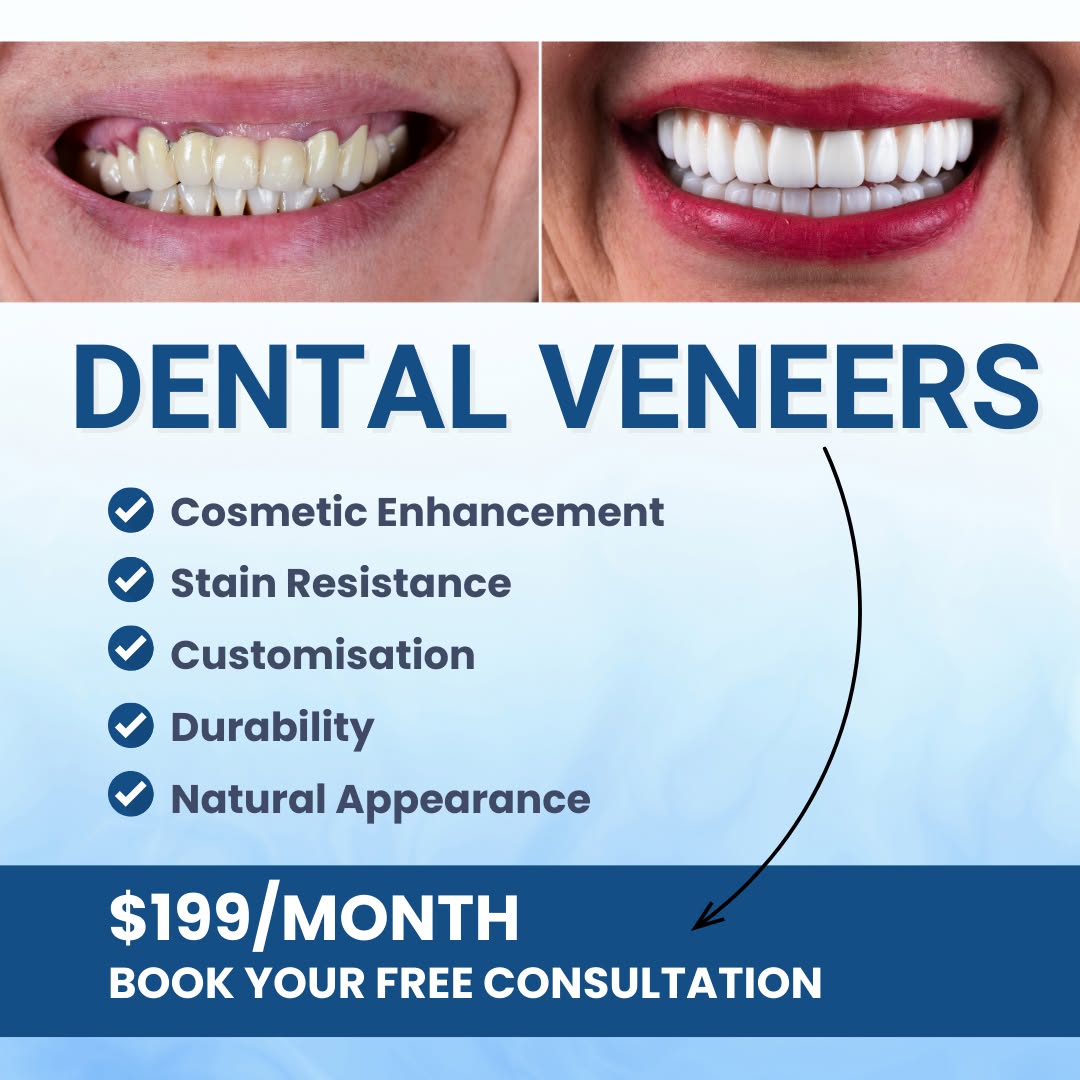 Nashville Aesthetics & Implants Facebook ad: Dental Veneers - FREE Consultation