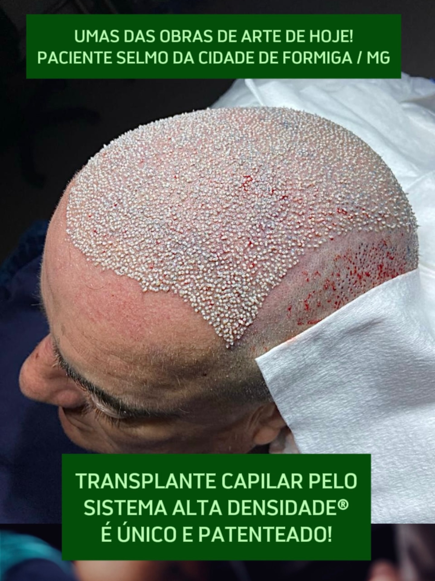 Grupo Capilar Brasil Facebook ad: Grupo Capilar Brasil | Criadores do Sistema de Alta…