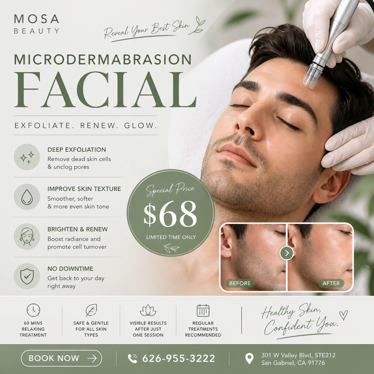 Mosa Beauty Medical Center SG Facebook ad: Upgrade Your Skin Game Men’s Facial $68