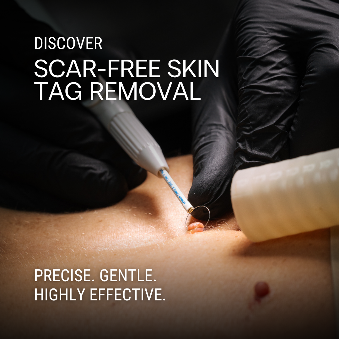 Contour Clinics Facebook ad
